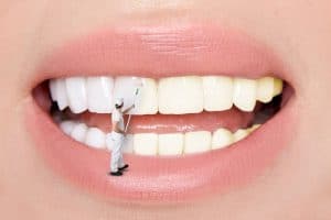 affordable-teeth whitening sunnynook dentist