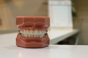 northshore auckland denture