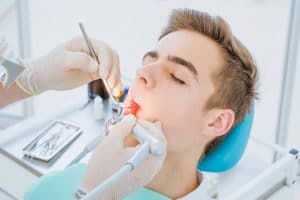 northshore auckland painless rootcanal