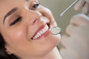 northshore auckland teeth whitening